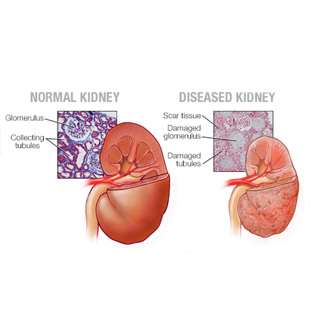 Kidney Specialist In Jammu